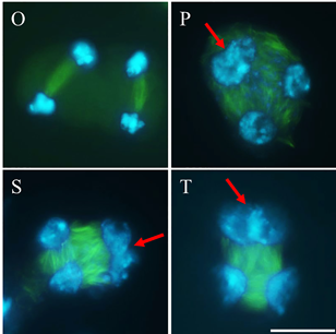 Cold interferes with male meiotic cytokinesis in Arabidopsis thaliana independently of the AHK2/3-AHP2/3/5 cytokinin signaling module￼